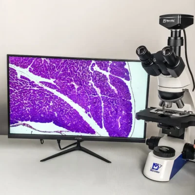msd-s750-1000-eyepiece-trinocular MSD-S750-1000 microscope connected to monitor showing high-resolution sample image