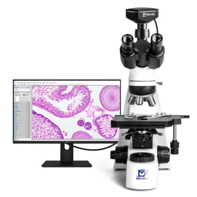 msd-s760-1000-laboratory-microscope-display Laboratory biomicroscope with digital display