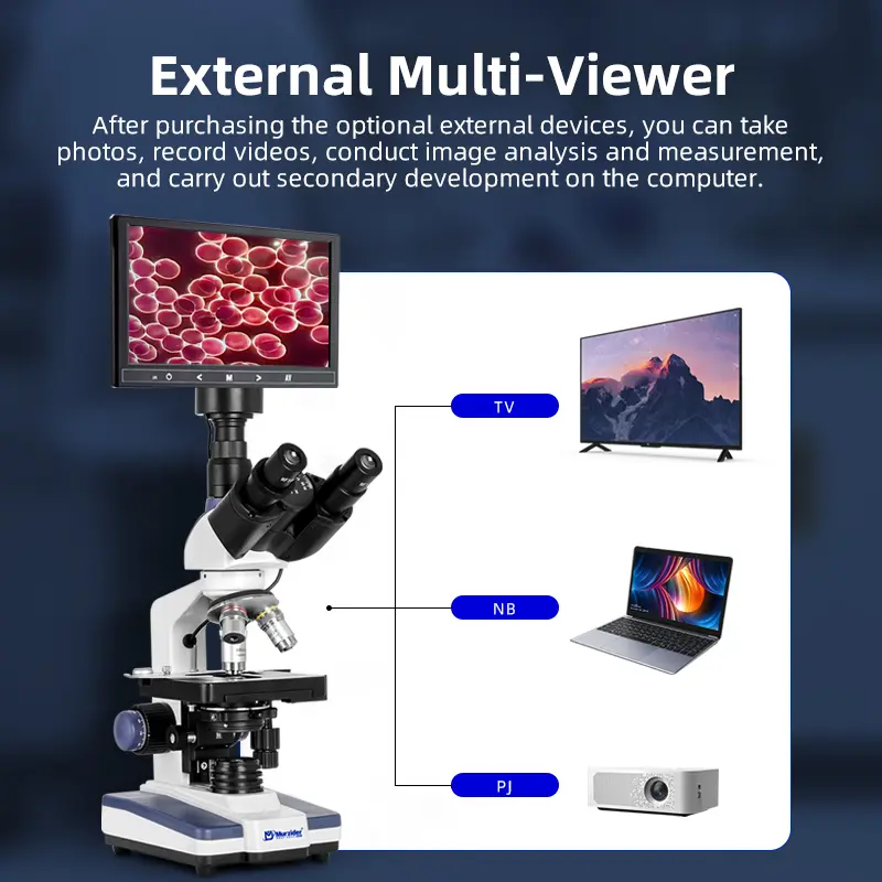 msd1012-dark-field-microscope-result-3 dark field blood observation imaging detail